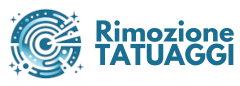 Rimozione Tatuaggi Brescia